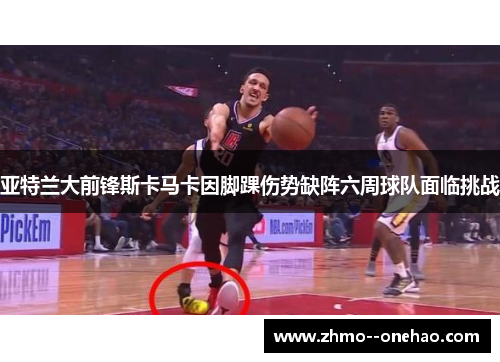 亚特兰大前锋斯卡马卡因脚踝伤势缺阵六周球队面临挑战